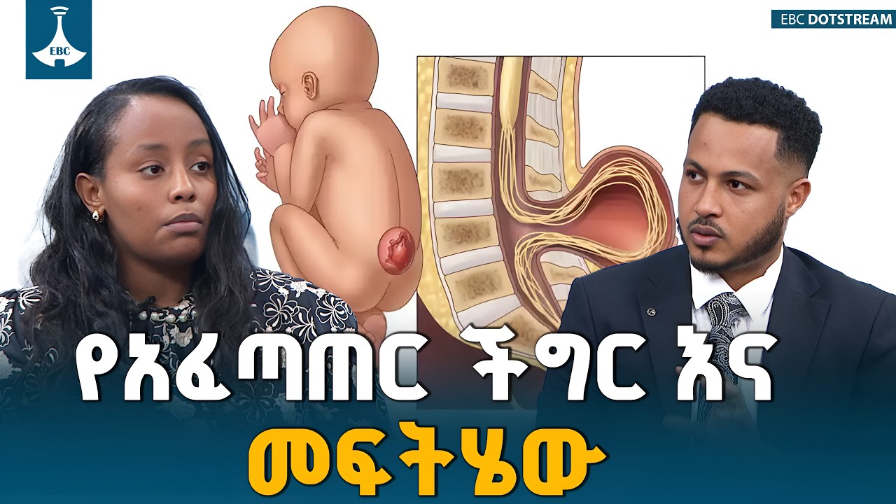 EBC interview: Congenital malformation and how it is treated